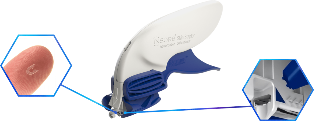 Diagram showing INSORB Skin Stapler staples, device, alignment guides on device