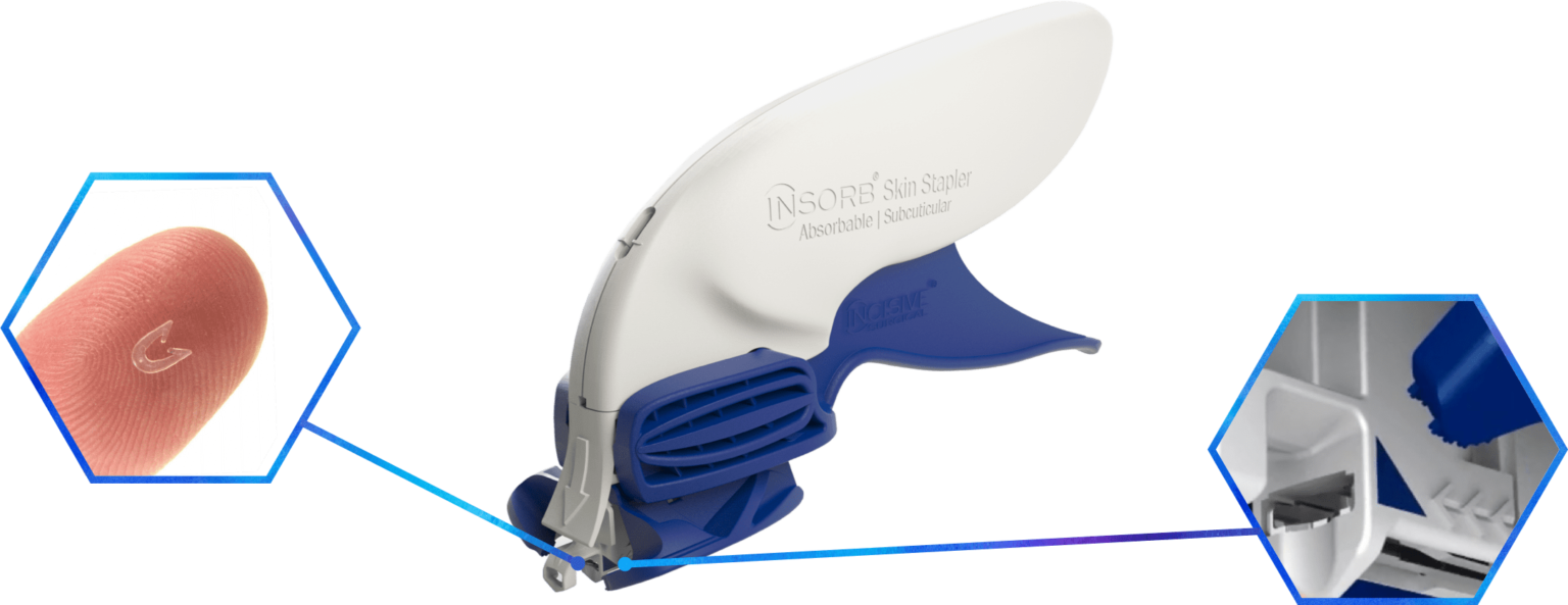 Why Suture & Staple with the INSORB Absorbable Skin Stapler?